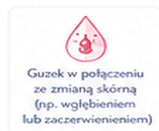 Guzek z objawami skóry lub brodawki